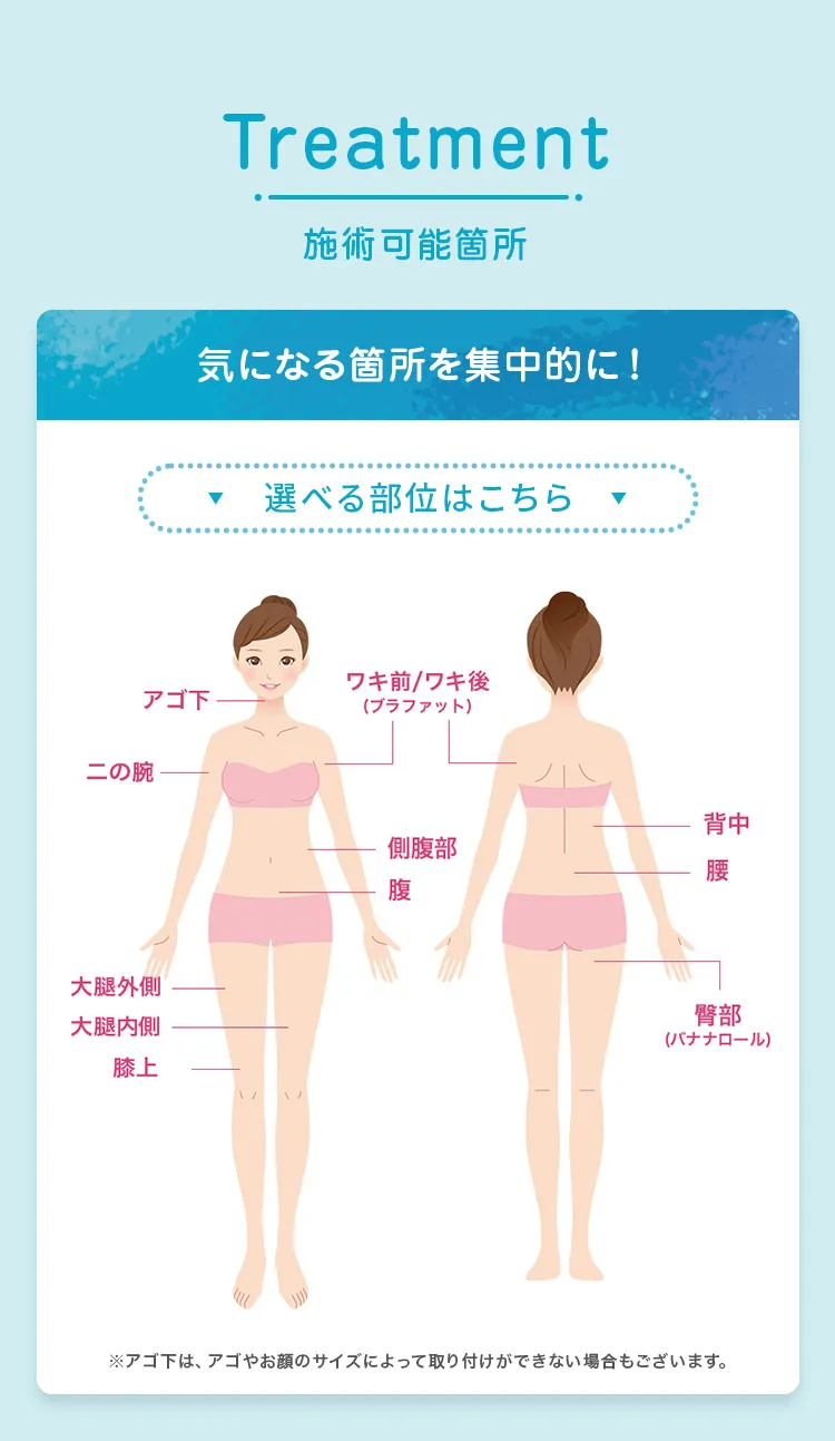 施術可能箇所