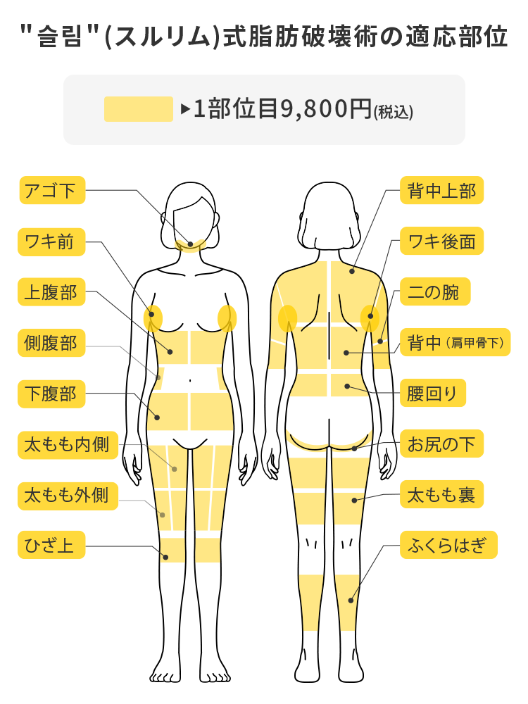 ＂スルリム（슬림）＂式 脂肪破壊術の適応部位