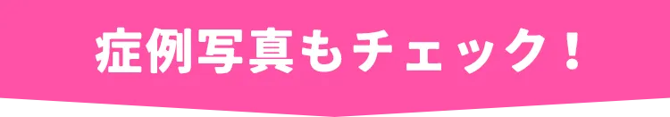 症例写真をチェック